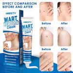 White Boutique Body Flat Point Mole Remove Wart Cream