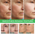 Deep Anti-wrinkle Essence Tightens And Lightens The Face