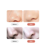 Household Pore Cleaner Electric Blackhead Absorber