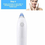 Blackhead Electric Pore Export Blackhead Cleaner