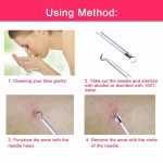 Ear Wax Remover Spoon Earwax Picker And Pimple Blackhead Remover Tools - COMBO KIT