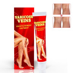 Vein Skin care lotion Shu Soft Earthworm Leg Vascular Tube Cream