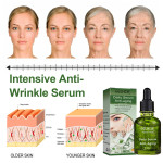 Deep Anti-wrinkle Essence Tightens And Lightens The Face